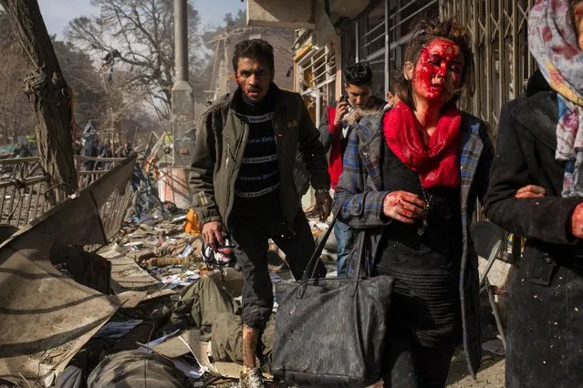 This incredible picture of a woman covered in blood in Kabul was one of the star entries at the photographic awards. (Photo by Andrew Quilty/World Press Photo 2019)