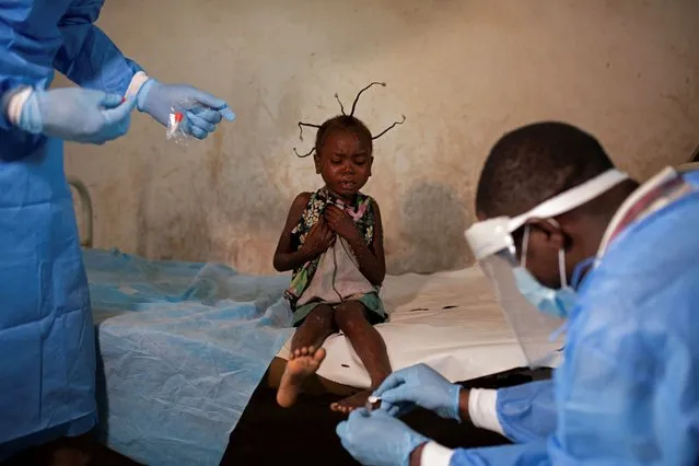 Theopiste Maloko, 42, a local health official, and a nurse collect skin samples from Angelika Lifafu, 6, to test for monkeypox, at the Yalolia health centre, in Tshopo, Democratic Republic of Congo, October 3, 2022. Without treatment, Angelika can only wait for the illness to run its course. Ahead of her lies a myriad of possible outcomes including recovery, blindness, or, as was the case with a family member in August, death. “These children have a disease that makes them suffer so much”, said Angelika's grandfather Litumbe Lifafu. “We demand the government provides medicines for us poor farmers, and the vaccine to fight this disease”. (Photo by Arlette Bashizi /Reuters)