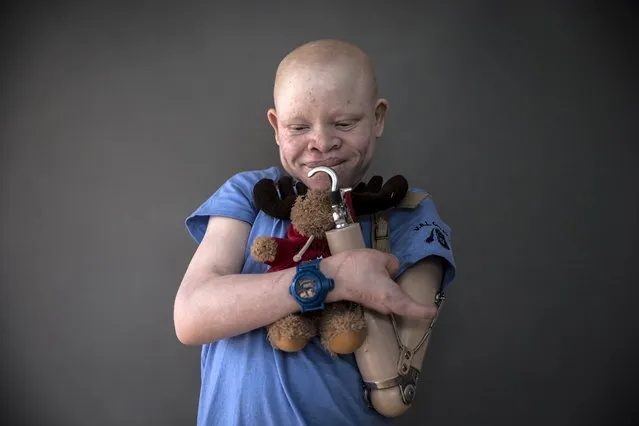 13-year-old Emmanuel Festo from Tanzania poses for a portrait with a plush toy that he says makes him feel safe at night and that he sleeps with, in New York's Staten Island, September 21, 2015. Albino body parts are highly valued in witchcraft and can fetch a high price. Superstition leads many to believe albino children are ghosts who bring bad luck. (Photo by Carlo Allegri/Reuters)