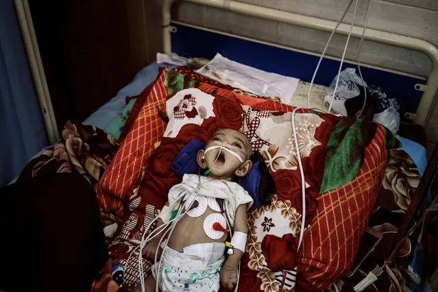 A young child gasps for air in the Intensive Care Unit of the al-Sadaqa Hospital, in Yemen. (Photo by Lorenzo Tugnoli/The Washington Post/Contrasto/World Press Photo 2019)