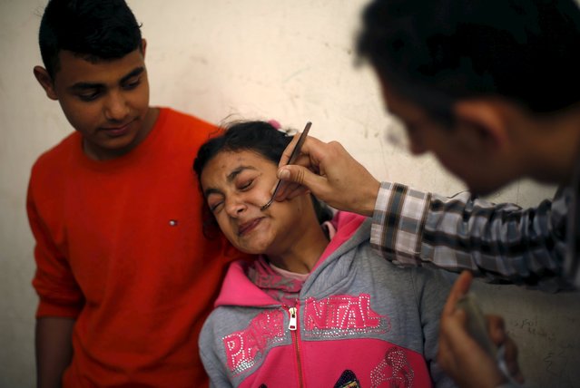 Palestinian girl Alya Al-Ghafari, who suffers from facial palsy, receives bee-sting therapy at Rateb Samour's clinic in Gaza City April 11, 2016. (Photo by Suhaib Salem/Reuters)