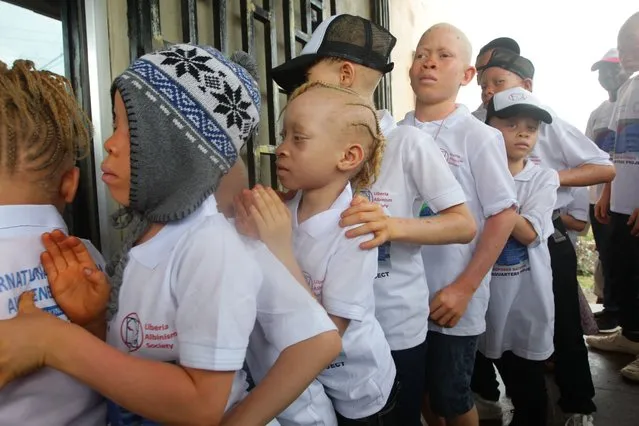 Liberian Albinos parade through the streets during an event held to mark International Albino Awareness Day in Monrovia, Liberia, 13 June 2022. According to reports, the Liberia Albino Society petitioned members of the National Legislature to enact a law that would end discrimination and provide empowerment for its members. International Albinism Awareness Day is observed annually on 13 June to celebrate the human rights of persons with albinism, and to battle discrimination against those diagnosed with albinism worldwide. The United Nations' General Assembly adopted a resolution, establishing 13 June as International Albinism Awareness Day, which confirmed global focus on albinism advocacy, and encourages everyone to celebrate and promote albinism awareness globally. Albinism is a rare, non-contagious condition; both parents must carry the gene in order for it to be passed on, regardless if they themselves do not have albinism. (Photo by Ahmed Jallanzo/EPA/EFE)