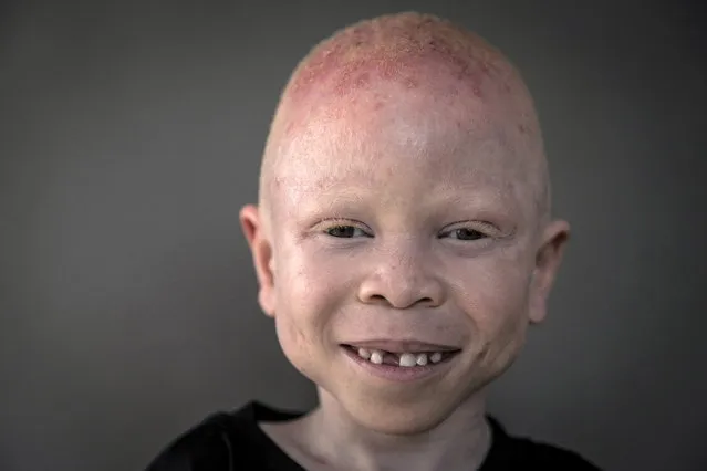 5-year-old Baraka Cosmas from Tanzania poses for a portrait in Staten Island. (Photo by Carlo Allegri/Reuters)