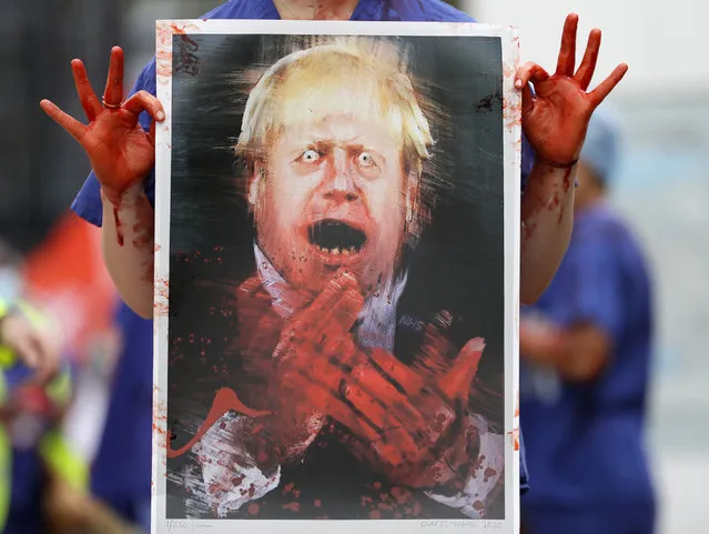 A nurse holds a painting of Prime Minister Boris Johnson clapping with blood on his hands as part of a demonstration of NHS workers at hospitals across London to demand a 15 per cent pay rise by the government in London, Wednesday, August 26, 2020.(Photo by Kirsty Wigglesworth/AP Photo)
