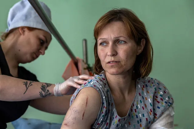 A nurse checks the wounds of Natalia Ponomareva, 51, only three days after her family's home was shelled by Russian forces in their frontline village of Vysokopilla in the Kherson region of southern Ukraine on May 05, 2022 in Kryvyi Rih, Ukraine. She said the family escaped, while still under fire, to a Ukrainian army checkpoint and was then transported to a regional trauma hospital. Her daughter, 5, was seriously injured and just released from the intensive care unit of another hospital. The central Ukrainian city and district of Kryvyi Rih, known as an industrial center and the hometown of President Volodymyr Zelensky, lies less than 70km north of Russian-occupied areas in nearby Kherson Oblast, where invading Russian forces have sought to create a land bridge between the Crimean peninsula and  the eastern Donbas region. (Photo by John Moore/Getty Images)