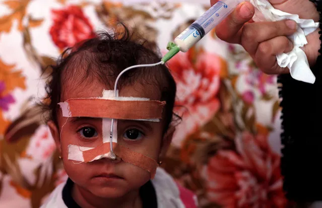 A Yemeni woman feeds her malnourished child through a tube at a UN-supported hospital in Sana’a, Yemen, 20 October 2020. According to reports, the United Nations has reduced and suspended 16 UN life-saving humanitarian programs in Yemen and 26 others are threatened with closure until the end of 2020 due to lack of funding, calling on international donors to urgently provide much needed humanitarian aid to millions of vulnerable people in the war-torn country. Nearly 80 percent of war-ridden Yemen's 29 million-population rely on humanitarian aid. (Photo by Yahya Arhab/EPA/EFE)