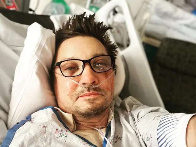 American actor Jeremy Renner early January 2023 posted a picture of himself looking broken and bruised in the wake of the accident and said: “I'm too messed up to type”. The Marvel star broke his silence on social media after he was hurt while helping to clear snowy roads for his family on New Year's Day. (Photo by Jeremy Renner/Instagram)