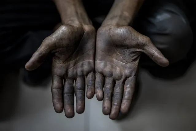 A child laborer displays his hands after being rescued in a raid by Bachpan Bachao Andolan, or Save the Childhood Movement, at a garage in New Delhi, India, Thursday, August 26, 2021. Police accompanied by activists of the children’s rights group on Thursday raided automobile repair shops on the edge of the Indian capital, rescuing 17 children illegally employed as daily wage workers. Activists from Bachpan Bachao Andolan, whose founder Kailash Satyarthi won the Nobel Peace Prize in 2014, went from one repair shop to another, freeing children whose hands, clothes and feet were smeared with grease. (Photo by Altaf Qadri/AP Photo)