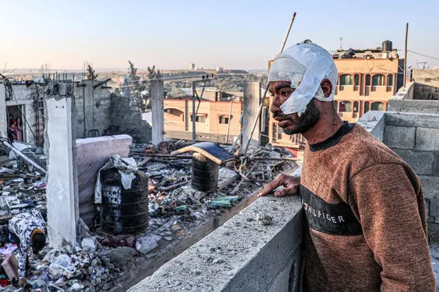 An injured man with a bandaged head looks on while standing next to the rubble and debris of a destroyed building in the aftermath of Israeli bombardment on Rafah in the southern Gaza Strip on February 7, 2024, amid the ongoing conflict between Israel and the Palestinian militant group Hamas. (Photo by Said Khatib/AFP Photo)