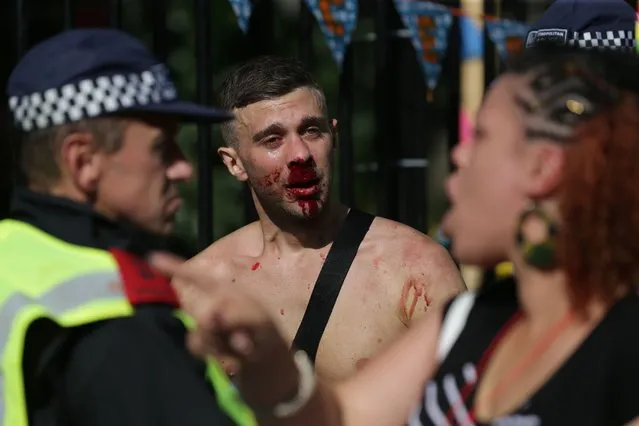 A man with a bloodied face speaks to police on the second day of the Notting Hill Carnival in west London on August 29, 2016. Nearly one million people are expected by the organizers Sunday and Monday in the streets of west London's Notting Hill to celebrate Caribbean culture at a carnival considered the largest street demonstration in Europe. (Photo by Daniel Leal-Olivas/AFP Photo)