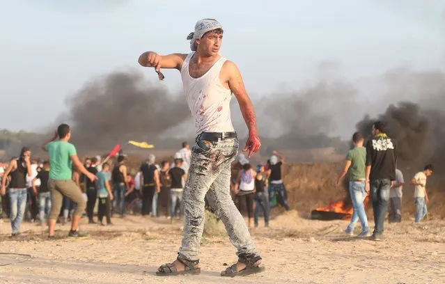 A Palestinian with blood on his clothes walks during clashes with Israeli troops near the border between Israel and Central Gaza Strip October 13, 2015. Seven Israelis and 28 Palestinians, including 10 alleged attackers and eight children, have died in almost two weeks of street attacks and security crackdowns. (Photo by Ibraheem Abu Mustafa/Reuters)