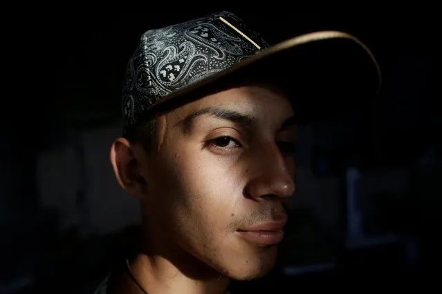 Daniel, who attends the meetings of Raza Nueva in Christ, a project of the archdiocese of Monterrey, poses for a picture to show a scar on his face, at his home in Escobedo, on the outskirts of Monterrey, Mexico, June 15, 2016. (Photo by Daniel Becerril/Reuters)