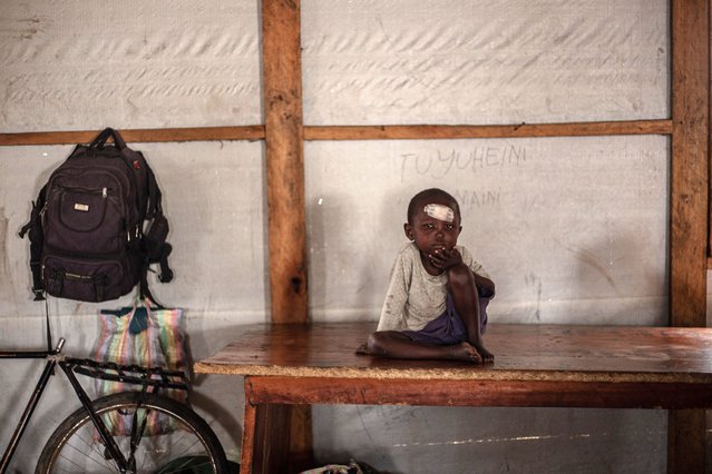 A boy with a bandage on his forehead sits inside a hangar at the Bulengo displaced persons camp, near Goma, North-Kivu province, on January 15, 2025. Fighting between the Congolese army and M23 fighters has caused a massive new wave of displacement, with the UN reporting last week that more than 100,000 people had fled their homes. Nearly 2,500 people arrived at the Bulengo displaced persons camp near Goma in recent days, official Mahoro Faustin told AFP. (Photo by Jospin Mwisha/AFP Photo)