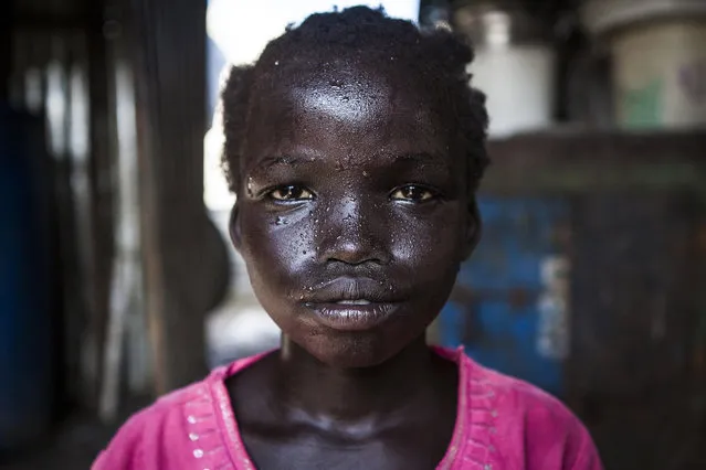 Mer, 10, covered in sweat from the afternoon heat before the rain, sits in her home in the Protection of Civilians (POC) site at the UNMISS base in Malakal, South Sudan on Friday, July 8, 2016. (Photo by Jane Hahn/The Washington Post)