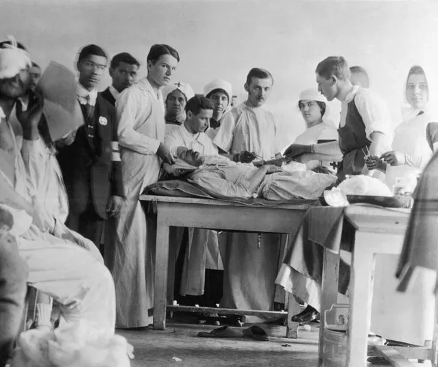 Surgeons operating on a wounded patient in a Serbian hospital during World War I, circa 1916. (Photo by FPG/Hulton Archive/Getty Images)