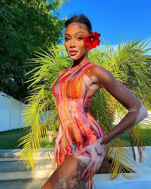 Canadian fashion model Winnie Harlow models her hibiscus lip mask in the last decade of August 2022. (Photo by winnieharlow/Instagram)