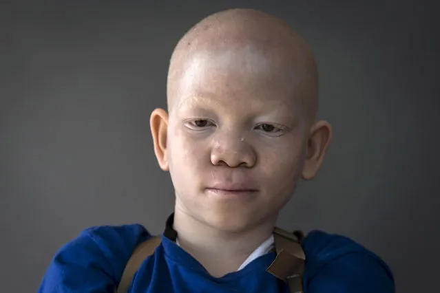 12-year-old Mwigulu Matonage from Tanzania poses for a portrait in Staten Island. (Photo by Carlo Allegri/Reuters)