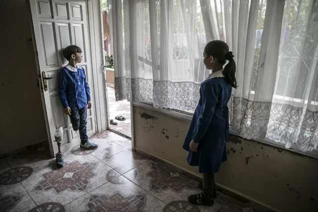 Luceyn Kifretune (R), 9 years-old Syrian girl whose face burnt and lost four of her family members after a barrel bomb attack of Assad Regime hit their house in Syria's Saraqib district, stares at her brother Omer (L), who lost his right leg in the same attack, at their house in Reyhanli district in uniforms of Yenisehir Elementary School, where they continue their education, in Reyhanli district of Turkey's Hatay province on October 17, 2019. Luceyn's face's right part burnt as she lost her father, mother, aunt and brother in the same attack. She received a successful surgery in Istanbul with the help of charities, after she and her family sheltered in Reyhanli. (Photo by Cem Genco/Anadolu Agency via Getty Images)