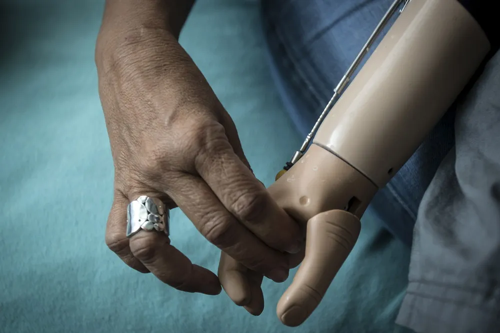 Rescued from the Albino Hunters