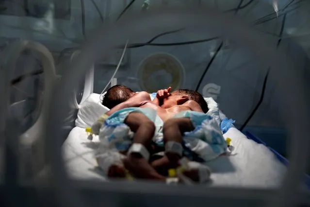 Newly born conjoined twins lie in an incubator at the child intensive care unit of al-Sabeen hospital in Sanaa, Yemen on December 18, 2020. (Photo by Khaled Abdullah/Reuters)