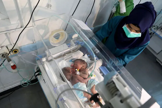 A nurse attends to newly born conjoined twins in an incubator at the child intensive care unit of al-Sabeen hospital in Sanaa, Yemen on December 18, 2020. (Photo by Khaled Abdullah/Reuters)