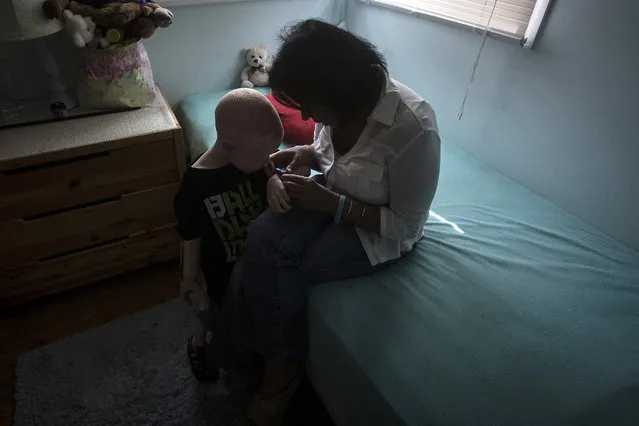 5-year-old Baraka Cosmas from Tanzania talks with Elissa Montanati of the Global Medical Relief Fund in his bedroom. (Photo by Carlo Allegri/Reuters)