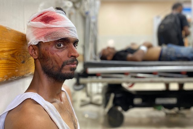 A wounded Palestinian man awaits medical attention at Khan Yunis' Nasser hospital in the southern Gaza Strip on June 19, 2025. (Photo by AFP Photo/Stringer)