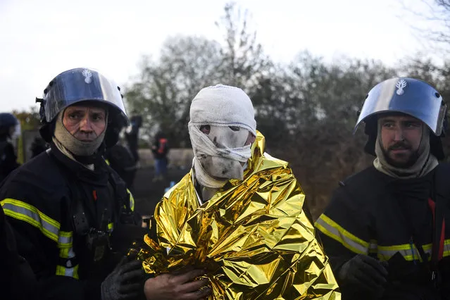 An anti- riot gendarmes, injured after receiving a cocktail molotov during clashes with protesters, receives medical assistance from firefighters at the ZAD (Zone a Defendre - Zone to defend) decade- old anti- airport camp in Notre- Dame- des- Landes, western France, on April 15, 2018. Police said hundreds of activists attacked officers on April 15, 2018 ahead of a peaceful rally to protest the forced closure of an anti- capitalist camp in western France. A week of clashes erupted on April 9, 2018 when police launched an eviction operation at Notre- Dames- des- Landes camp, near the city of Nantes, set up 10 years ago to fight plans for a new airport. (Photo by Damien Meyer/AFP Photo)