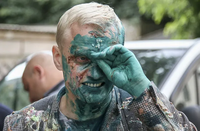 Vitaliy Shabunin, head of the non-governmental Anti-Corruption Action Centre, reacts after he was splashed with brilliant green substance during a rally in front of the Specialized Anti-Corruption Prosecutor's Office in Kiev, Ukraine July 17, 2018. (Photo by Viacheslav Ratynskyi/Reuters)