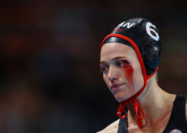 Canada's #06 Blaire Mcdowell bleeds due to an injury in the women's water polo 5th-8th classification match between Italy and Canada during the Paris 2024 Olympic Games at the Paris La Defense Arena in Nanterre, on August 8, 2024. (Photo by Evgenia Novozhenina/Reuters)