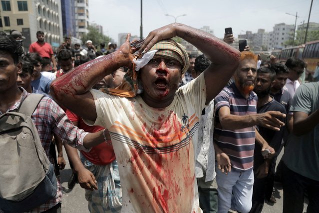 An injured protester is rushed to hospital after a clash with police and Awami League supporters at the Rampura area in Dhaka, Bangladesh on July 18, 2024. (Photo by Anik Rahman/Reuters)