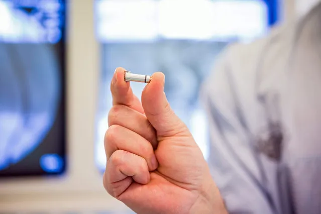A picture made available on 22 January 2016 shows the world's smallest artificial cardiac pacemaker at the University Hospital of Lord's Transfiguration in Poznan, Poland, 21 January 2016. Polish doctors have implanted the world's smallest artificial cardiac pacemaker. The device is 24 mm long, 6 mm in diameter, it weighs 1 gram and is 90 percent smaller and lighter than other pacemakers used traditionally. (Photo by Marek Zakrzewski/EPA)