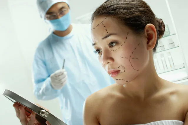 Woman with plastic surgery lines drawn on face. (Photo by Alamy Stock Photo)