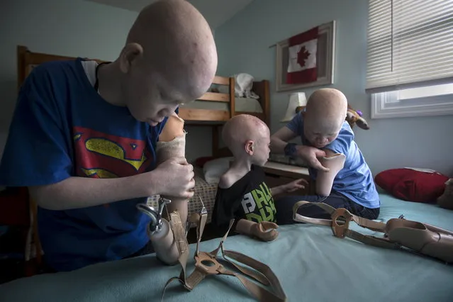 Mwigulu Matonage (L) and Emmanuel Festo (R) put on their prosthetic arms as Baraka Cosmas (C) looks on in their bedroom in Staten Island. (Photo by Carlo Allegri/Reuters)