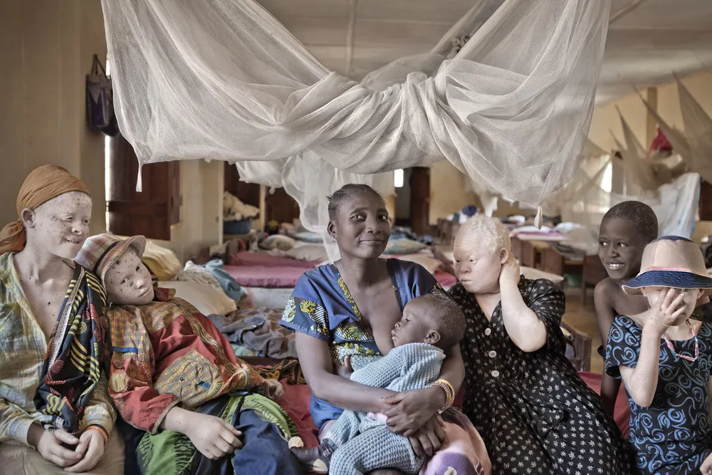 Albinos in Tanzania