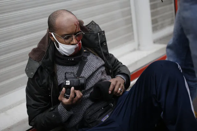 A man has blood on his face during a protest against a proposed bill , Saturday, December 12, 2020 in Paris. The bill's most contested measure could make it more difficult for people to film police officers. It aims to outlaw the publication of images with intent to cause harm to police. The provision has caused such an uproar that the government has decided to rewrite it. Critics fear the law could erode press freedom and make it more difficult to expose police brutality. (Photo by Lewis Joly/AP Photo)