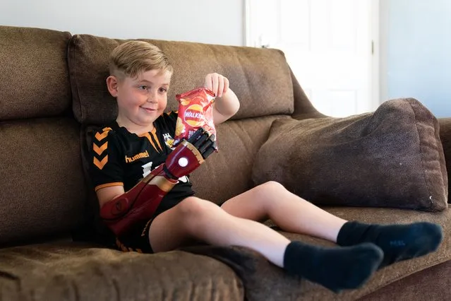 Louie Morgan-Kemp, seven, who was born without a right hand, demonstrates his new prosthetic arm called a Hero Arm, made by Bristol-based Open Bionics, at his home in Swavesey, Cambridgeshire on Wednesday, August 23, 2023, after receiving it on Tuesday. (Photo by Joe Giddens/PA Images via Getty Images)