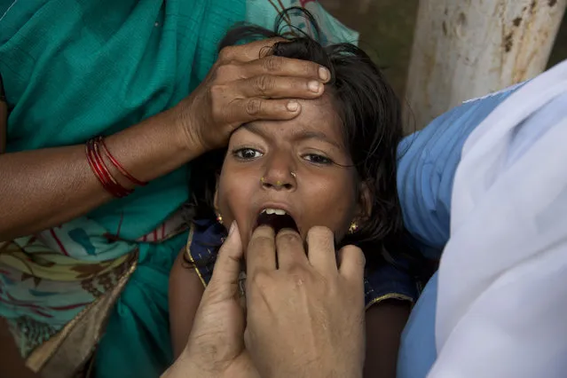 A young asthma patient is administered a traditional fish medicine in Hyderabad, India, Friday, June 8, 2018. Every year thousands of asthma patients arrive here to receive this fish therapy from the Bathini Goud family, a secret formula of herbs, handed down by generations only to family members. The herbs are inserted in the mouth of a live sardine, or murrel fish, and slipped into the patient's throat. (Photo by Mahesh Kumar A./AP Photo)