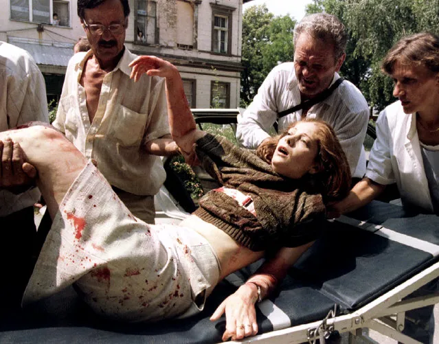 A wounded Bosnian woman is brought to Kosevo hospital in Sarajevo, July 26, 1995. (Photo by Reuters)