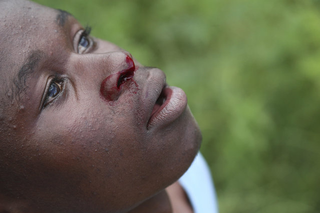 In this February 12, 2017 photo, a young boy nose bleeds after taking a few punches in a boxing ring in Chitungwiza, ZImbabwe. (Photo by Tsvangirayi Mukwazhi/AP Photo)