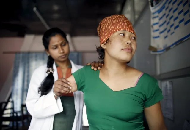 Nirmaya Tamang attends physiotherapy at Physical Rehabilitation Center which treats earthquake victims, in Kathmandu, Nepal April 4, 2016. A year on from an earthquake in Nepal that killed nearly 9,000 people, the Physical Rehabilitation Centre in the capital Kathmandu treats victims who lost limbs during the disaster. Some 22,000 people were injured and close to a million homes destroyed in the tiny Himalayan country in two earthquakes in April and May last year. (Photo by Navesh Chitrakar/Reuters)