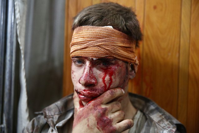 A Syrian injured young man look on at a make-shift hospital in the rebel-held area of Douma, east of the capital Damascus, following air strikes by Syrian government forces on a marketplace on August 16, 2015. At least 70 people were killed and 200 people were injured, with the death toll -most of them civilians- likely to rise as many of the wounded were in serious condition, the Syrian Observatory for Human Rights said. (Photo by Abd Doumany/AFP Photo)