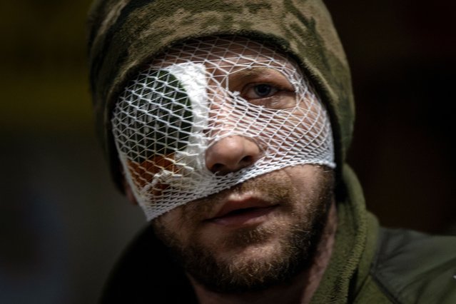 An injured soldier looks on in a medical stabilization point near the frontline on May 15, 2024in Donetsk region. (Photo by Thomas Peter/Reuters)