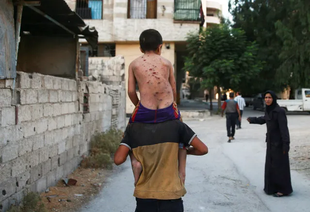 A man carries a wounded boy on his back in Arbin, a town in the Damascus countryside, Syria July 25, 2017. (Photo by Bassam Khabieh/Reuters)