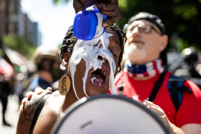 A woman has her eyes flushed during a protest against racial injustice in Portland, Oregon, U.S., August 22, 2020. (Photo by Maranie Staab/Reuters)