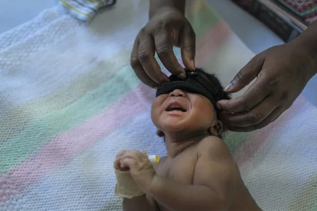 Issan Vilmar covers the eyes of her son before a light therapy session at the Saint Damien Pediatric Hospital of Port-au-Prince, Haiti, Friday, November 12, 2021. A powerful Haitian gang leader said Friday he is easing a chokehold on fuel deliveries that has caused a growing crisis for hospitals, gas stations and even water supplies across the nation’s capital. (Photo by Matias Delacroix/AP Photo)