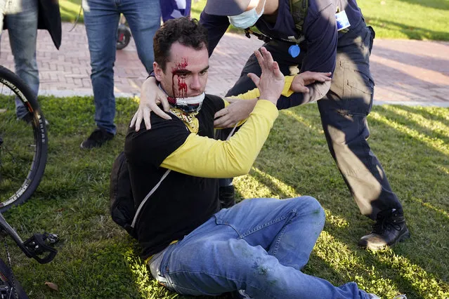 A counter-protester helps a supporter of President Donald Trump who was injured after he was attacked during a pro-Trump rally Saturday November 14, 2020, in Washington. (Photo by Jacquelyn Martin/AP Photo)