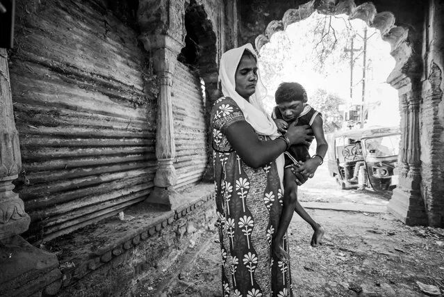 Abhay Kumar, 6 years old, with his mother Vineeta at home in the Dwarka Nagar neighborhood. Humera was born to parents contaminated by a carcinogenic and mutagenic water supply. (Photo by Giles Clarke/Getty Images)