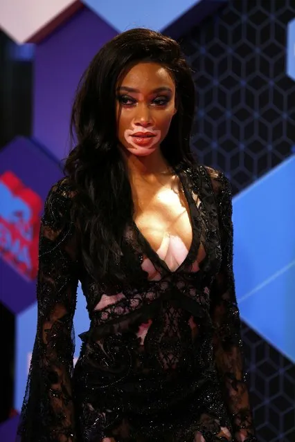 Model Winnie Harlow attends the 2016 MTV Europe Music Awards at the Ahoy Arena in Rotterdam, Netherlands, November 6, 2016. (Photo by Michael Kooren/Reuters)