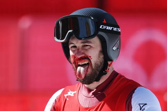 Daniel Hemetsberger of Team Austria reacts with blood on his face following the Men's Downhill on day three of the Beijing 2022 Winter Olympic Games at National Alpine Ski Centre on February 07, 2022 in Yanqing, China. (Photo by Alex Pantling/Getty Images)